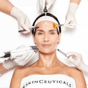 Microneedling (1 Session)