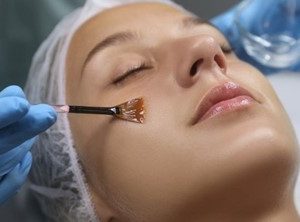 Advanced Eye Chemical Peel