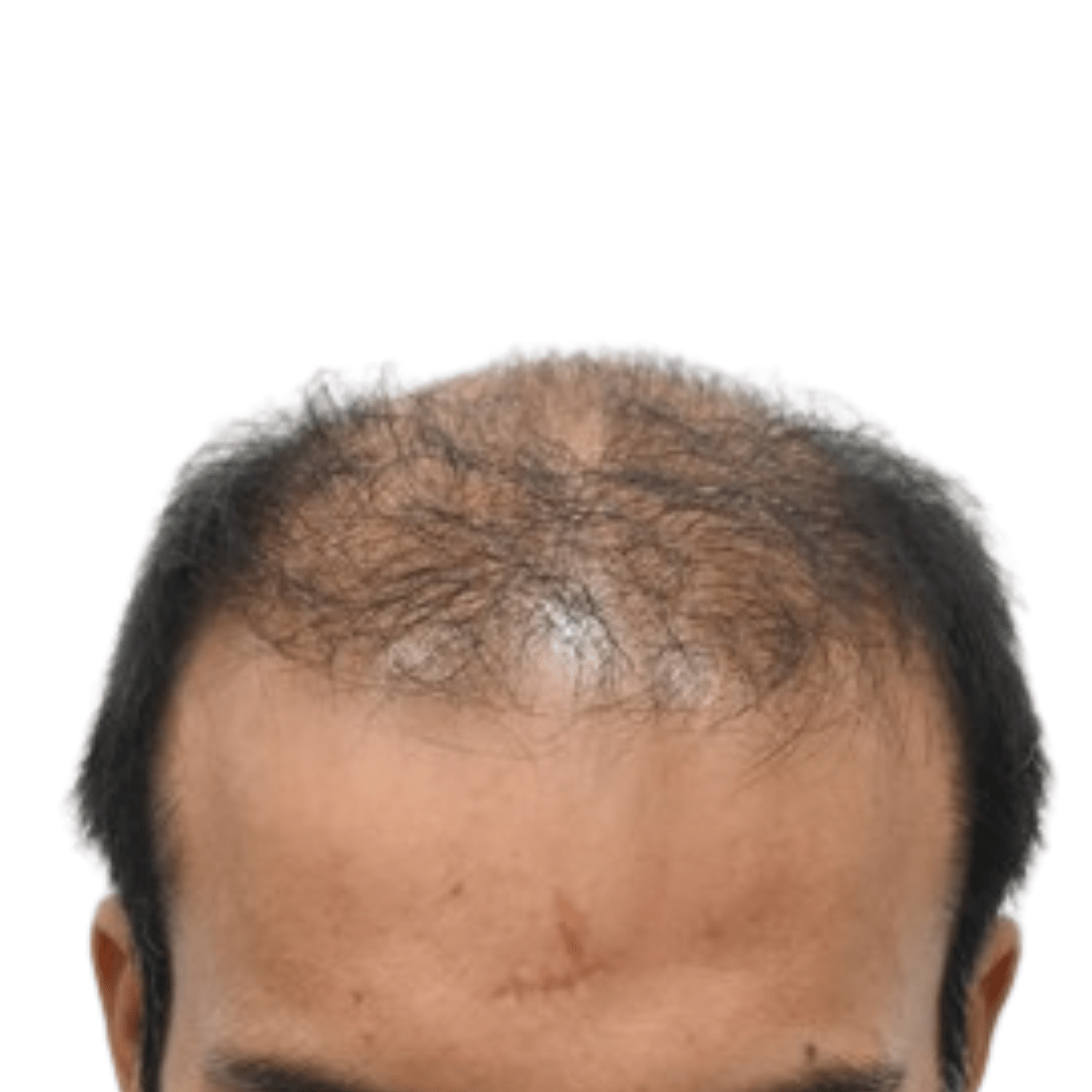 Before Patient 3