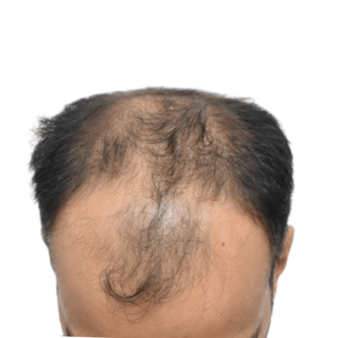 Before Patient 13 v2