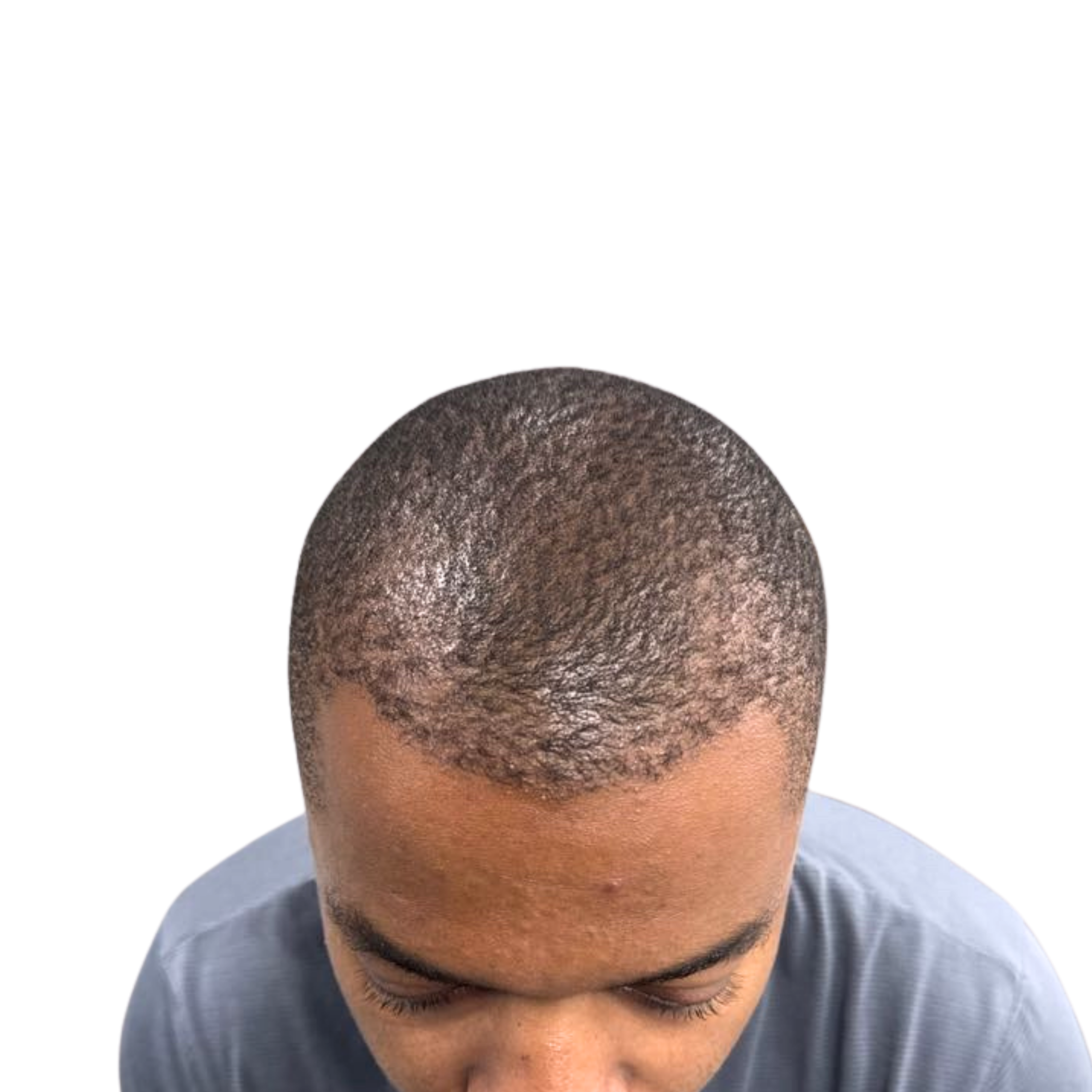 Afro 2 After