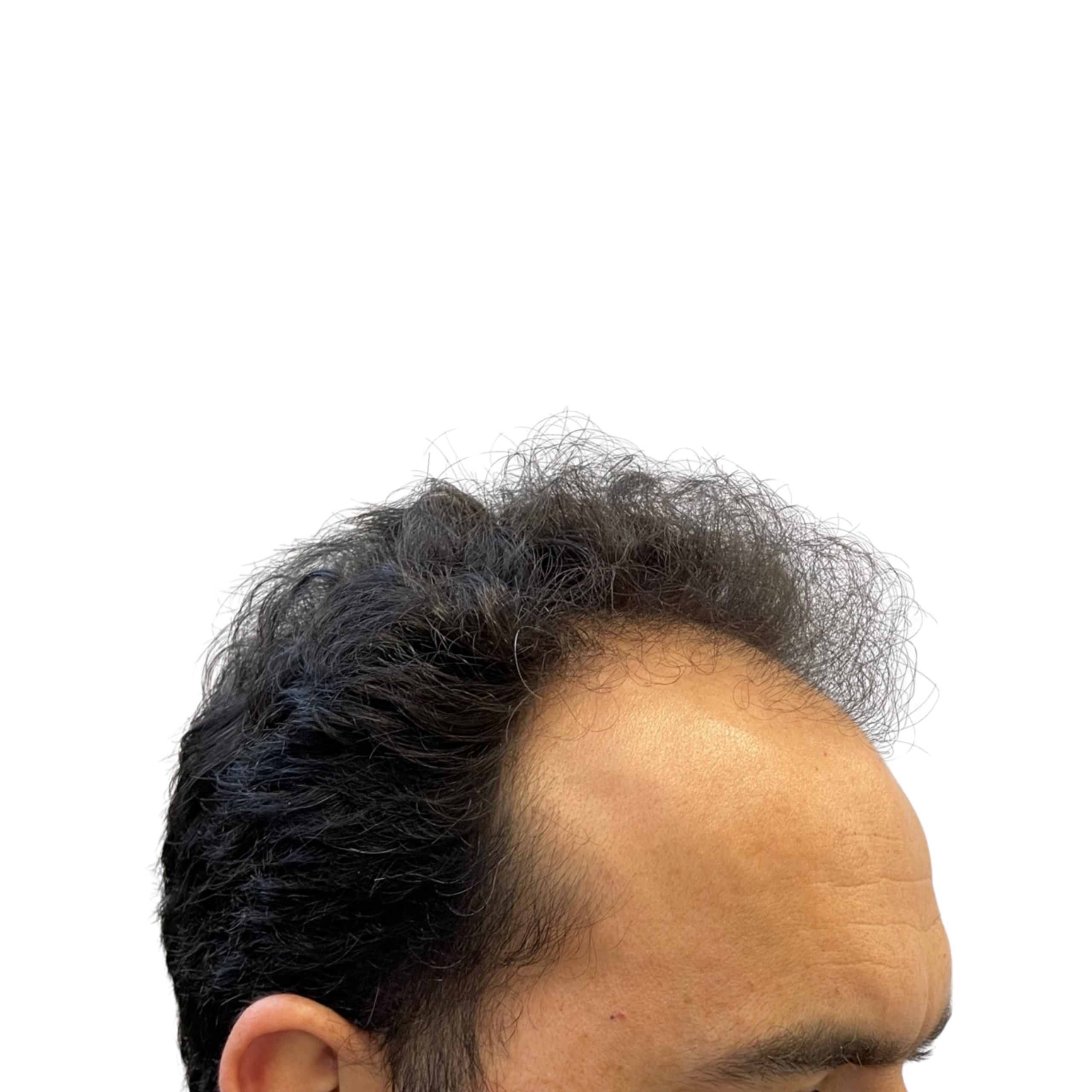 Ali Before
