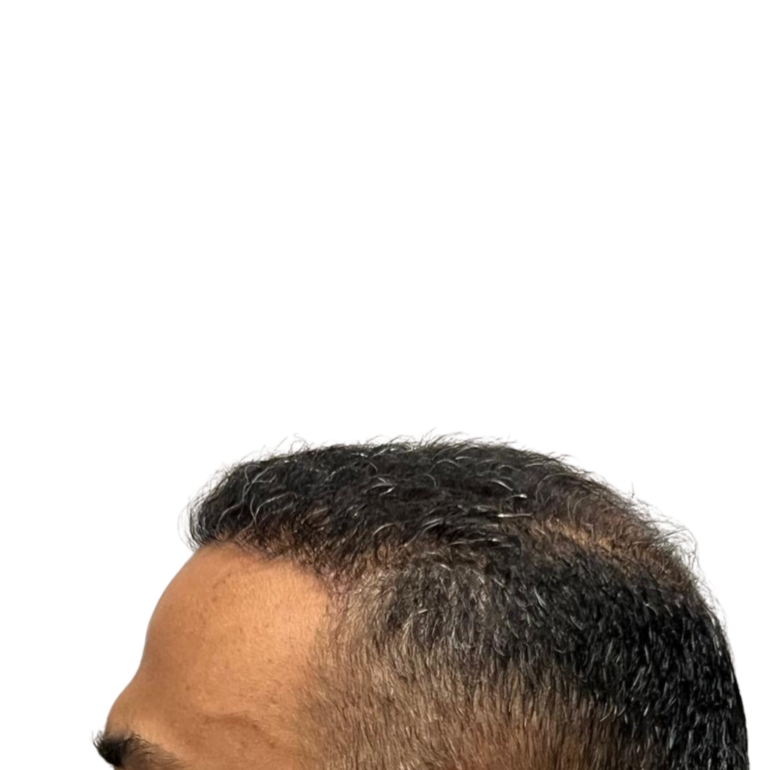 Amit After