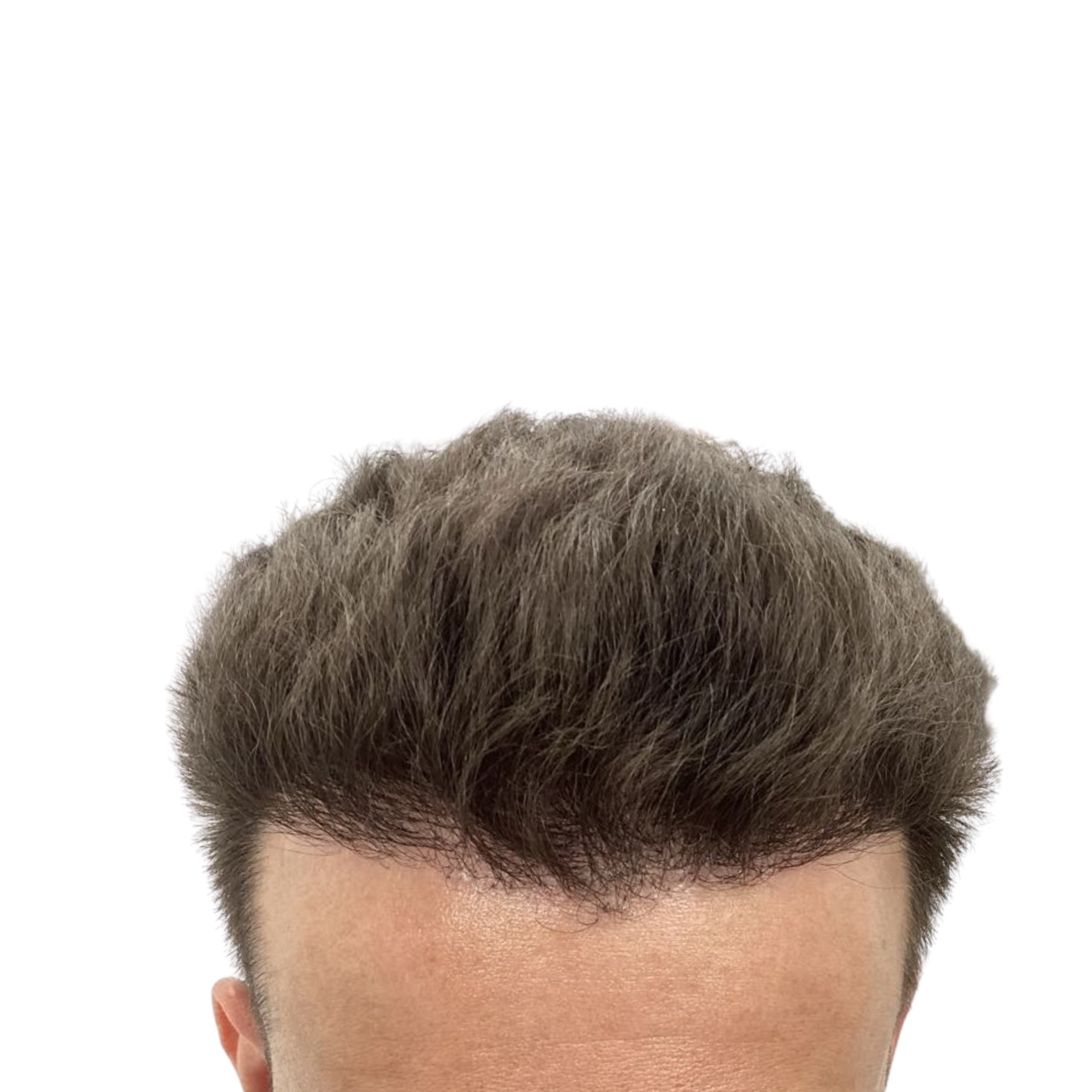 Artur After