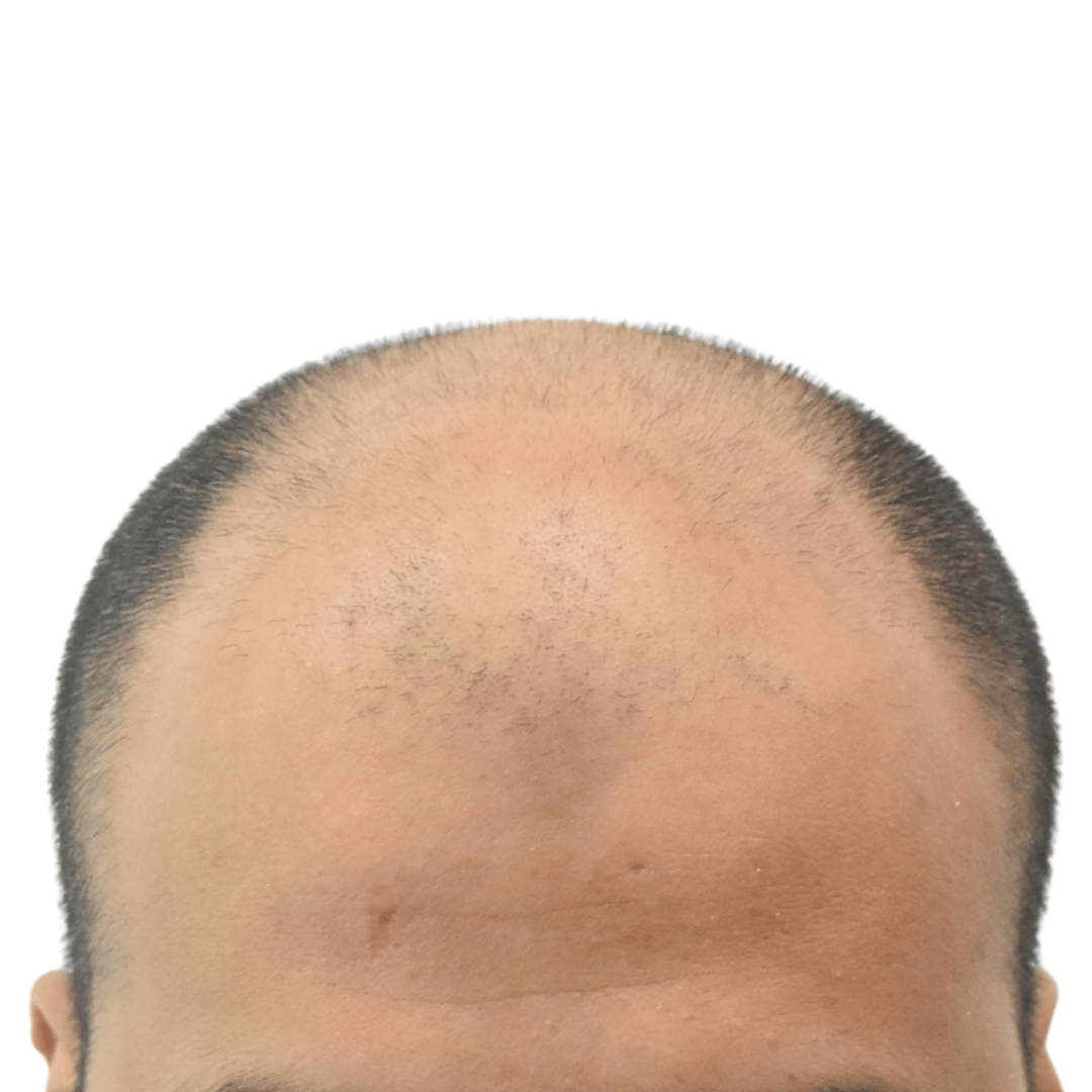 Before-Patient-6-v2