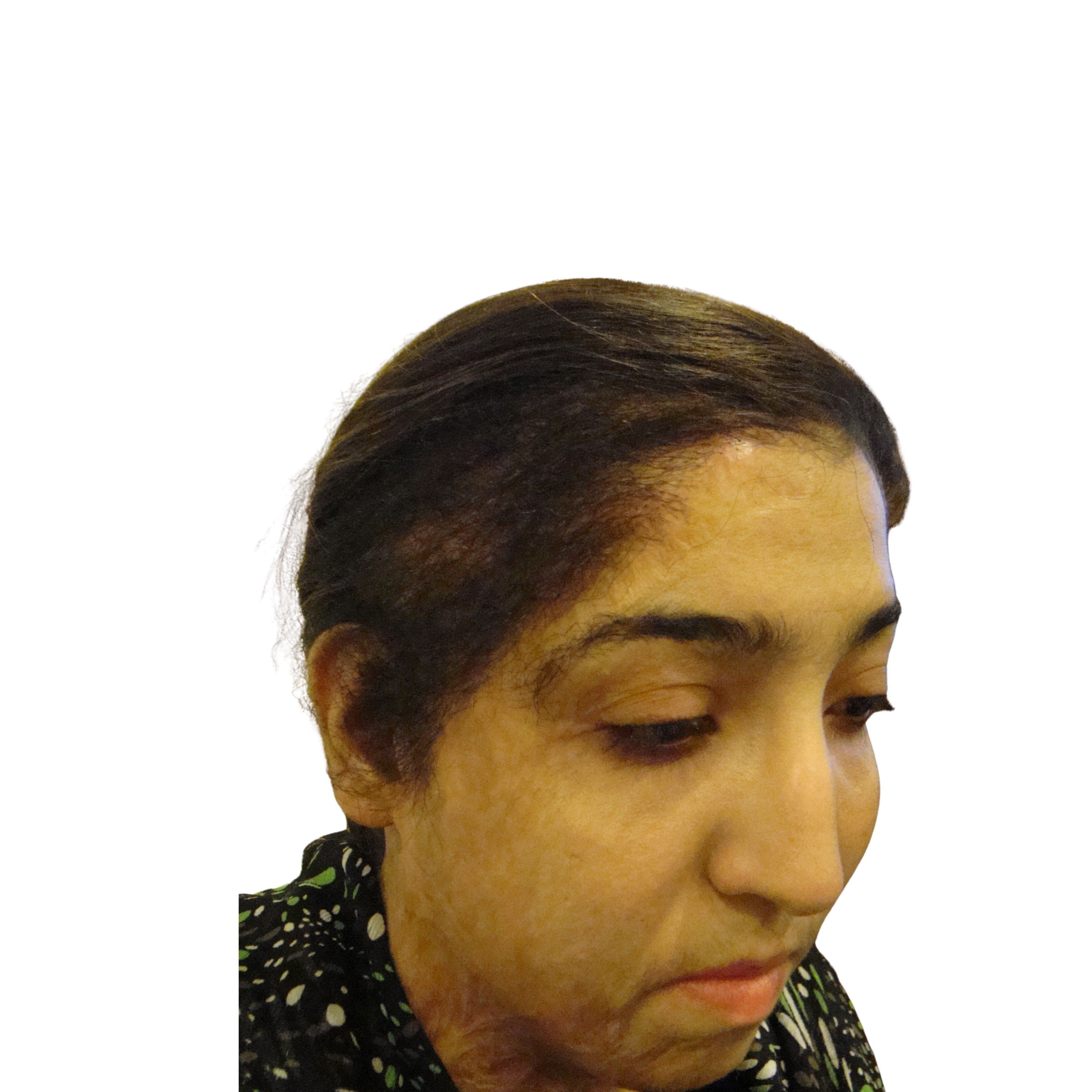 Fatima After