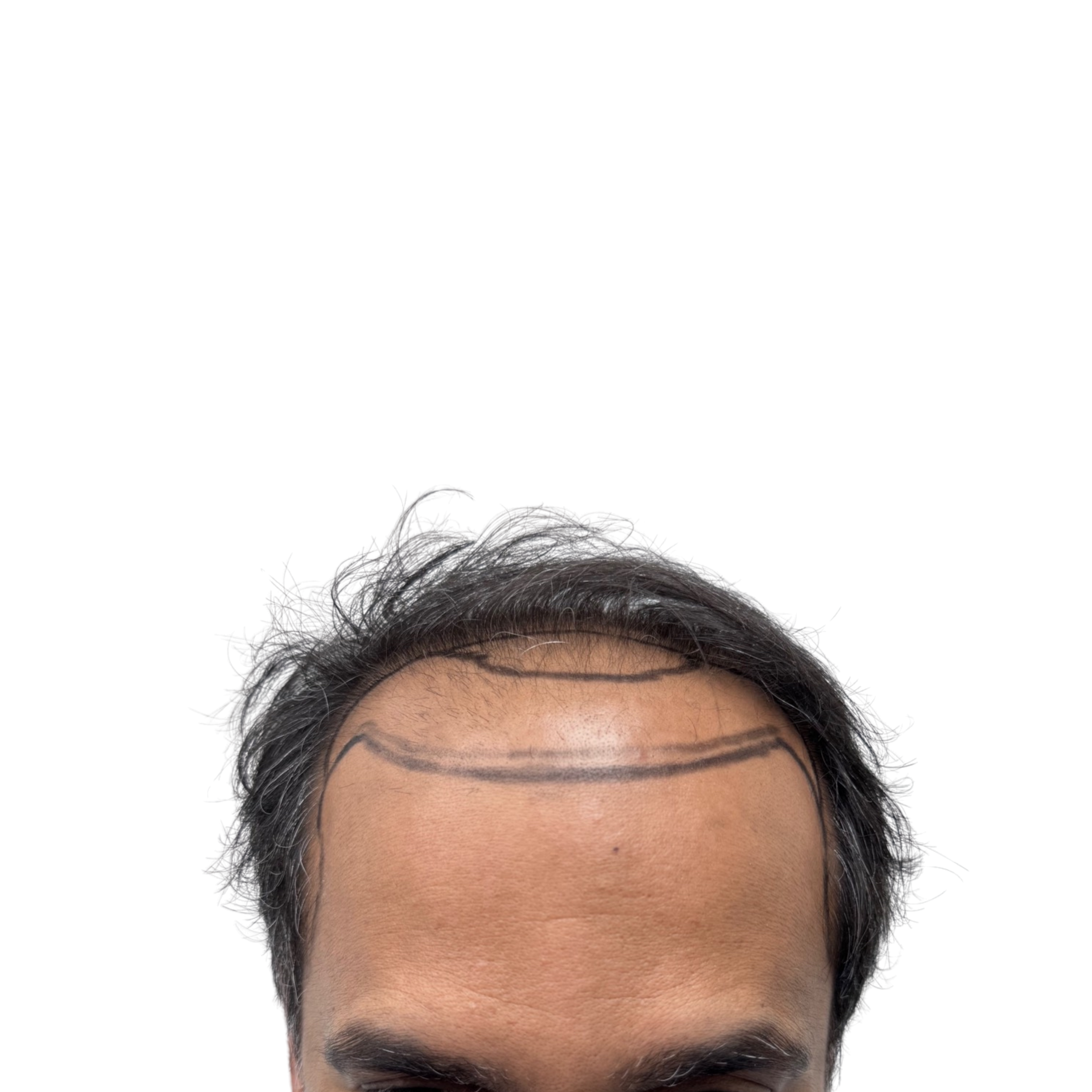 Imran before