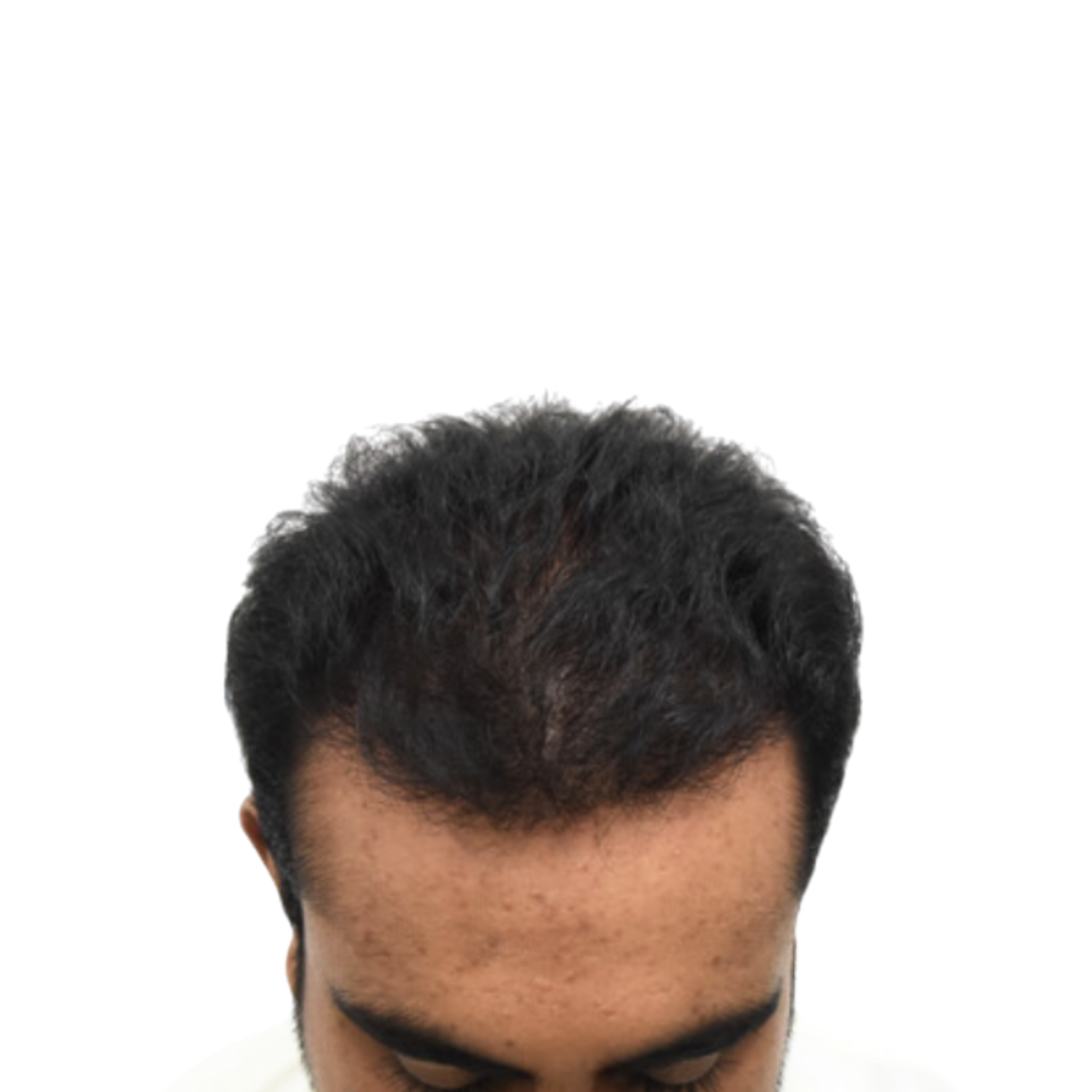 Nouman After