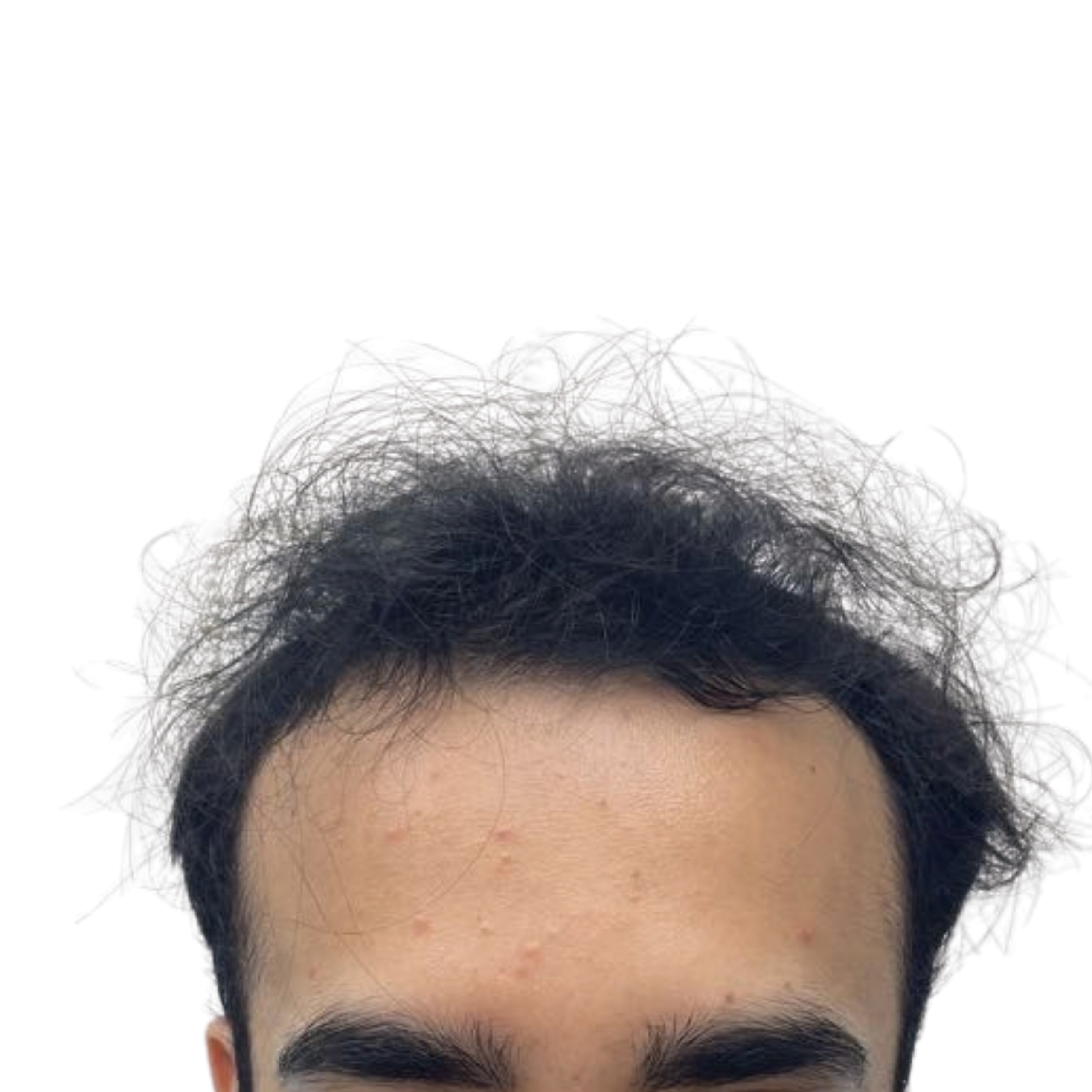 Omar before (2)