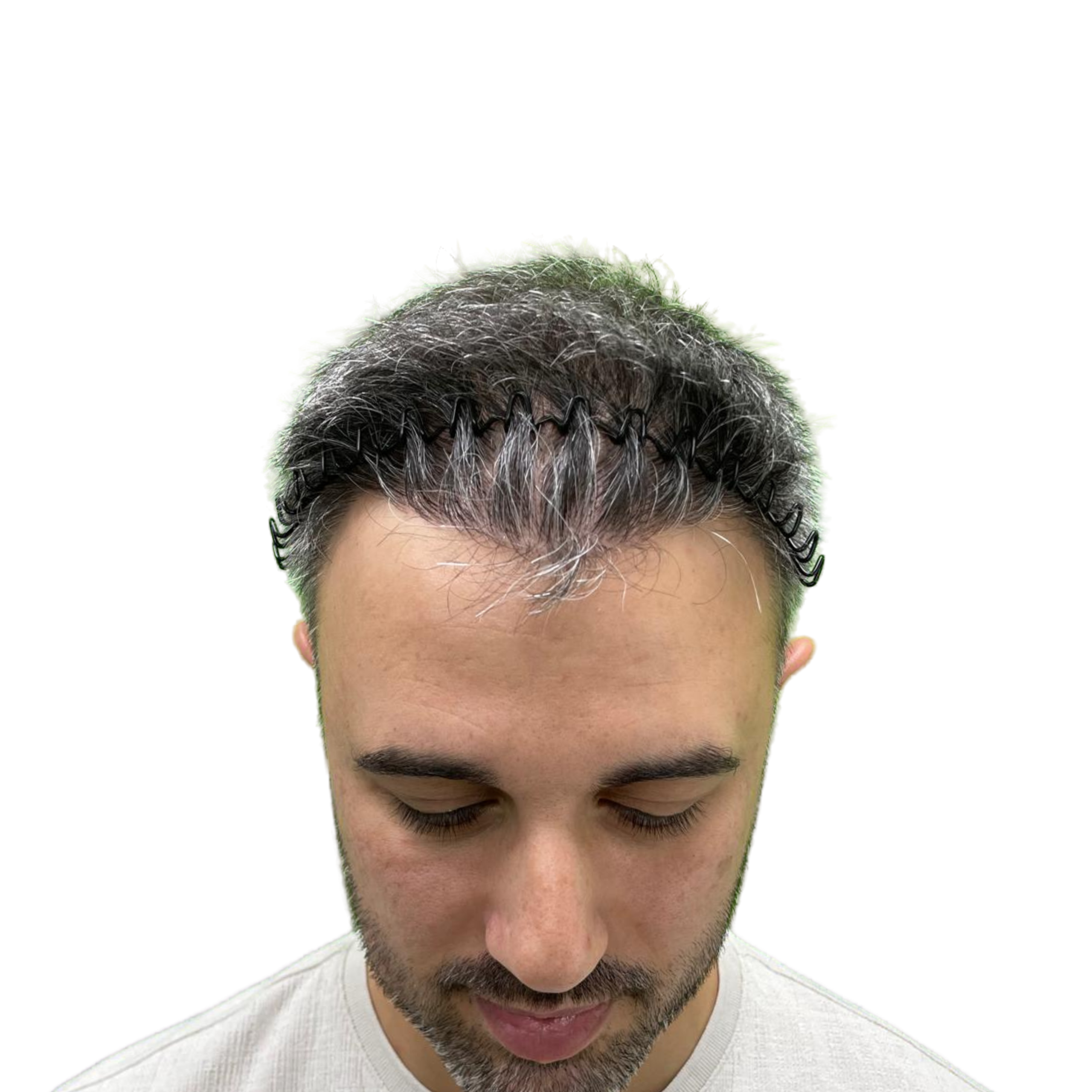 Orazio after