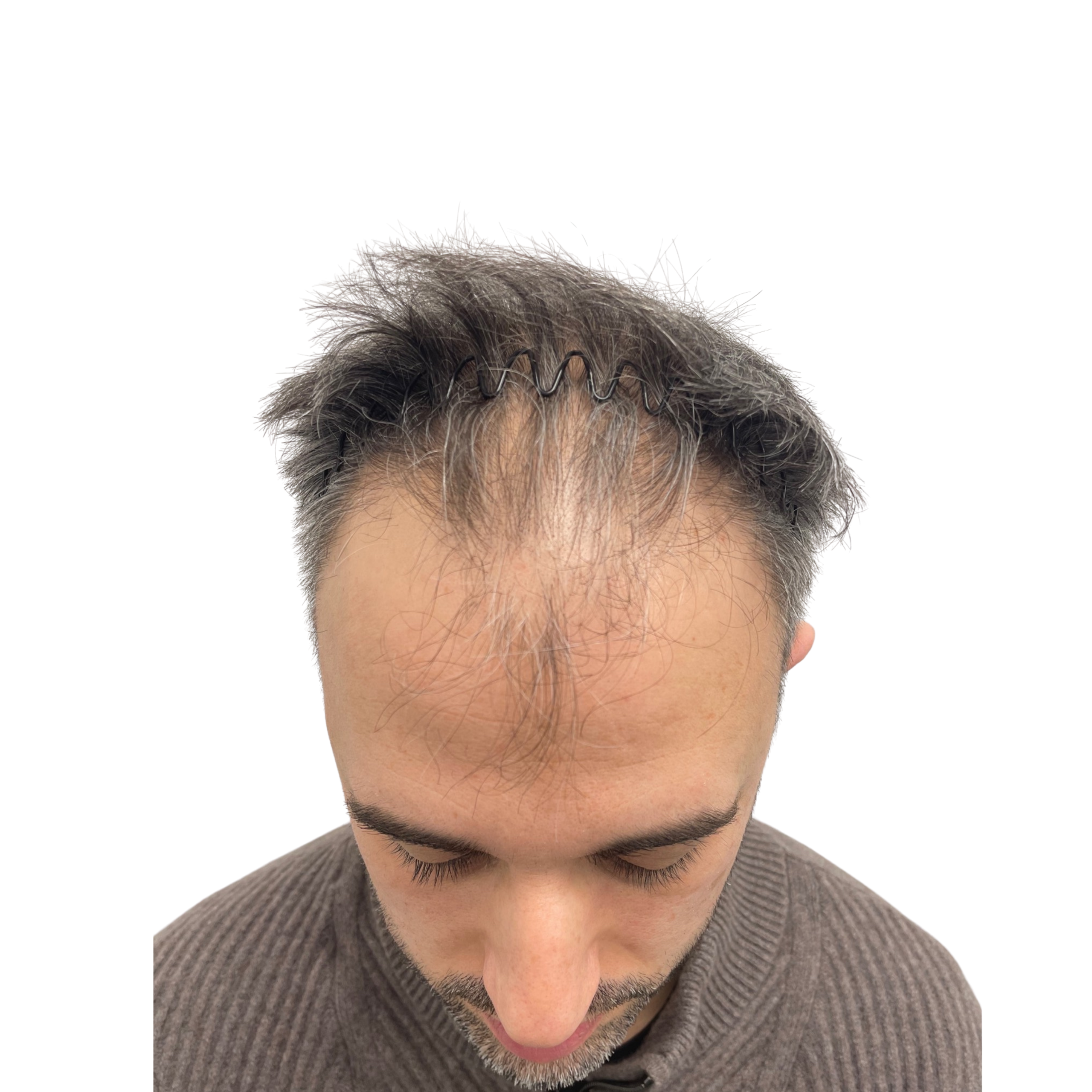 Orazio before