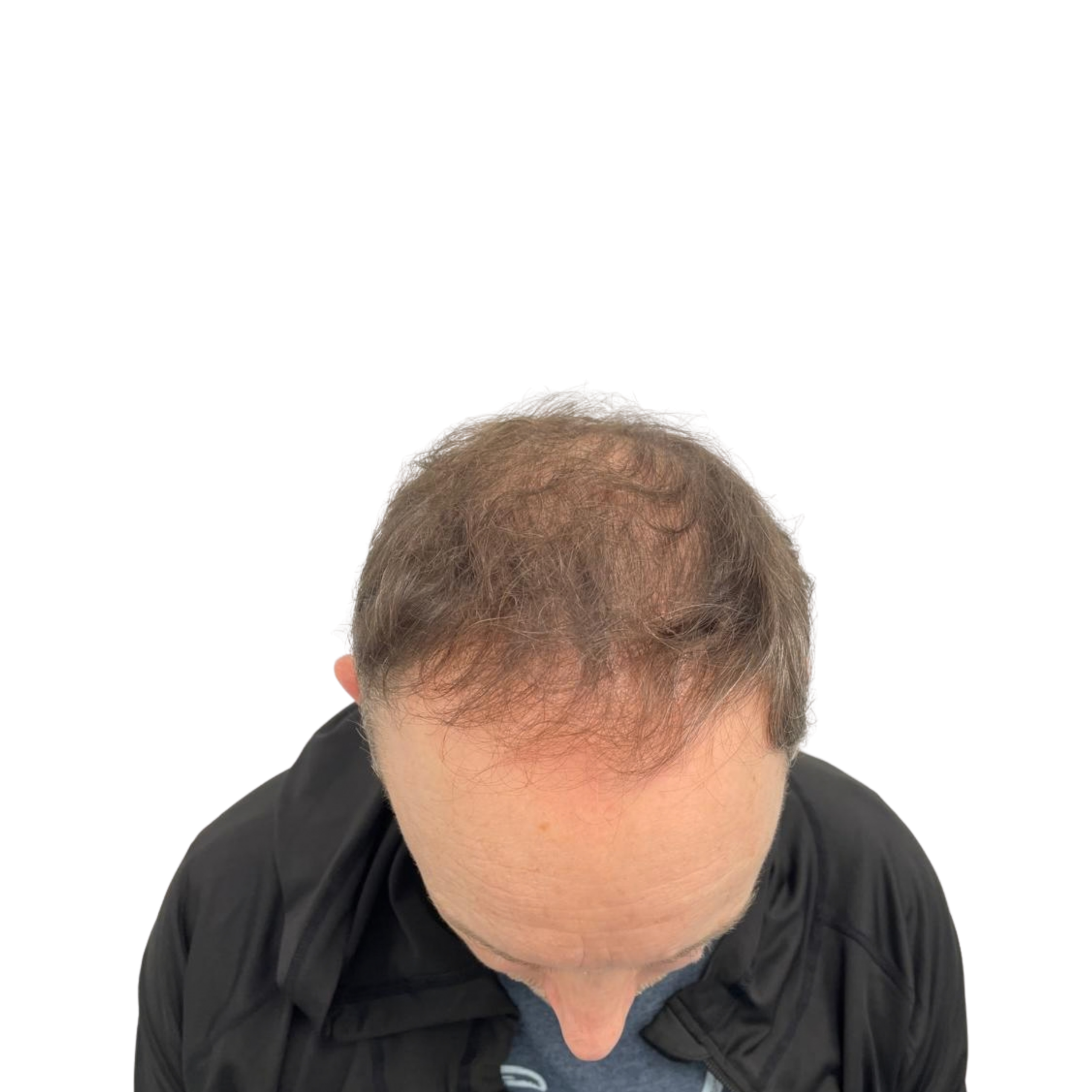 Paul before