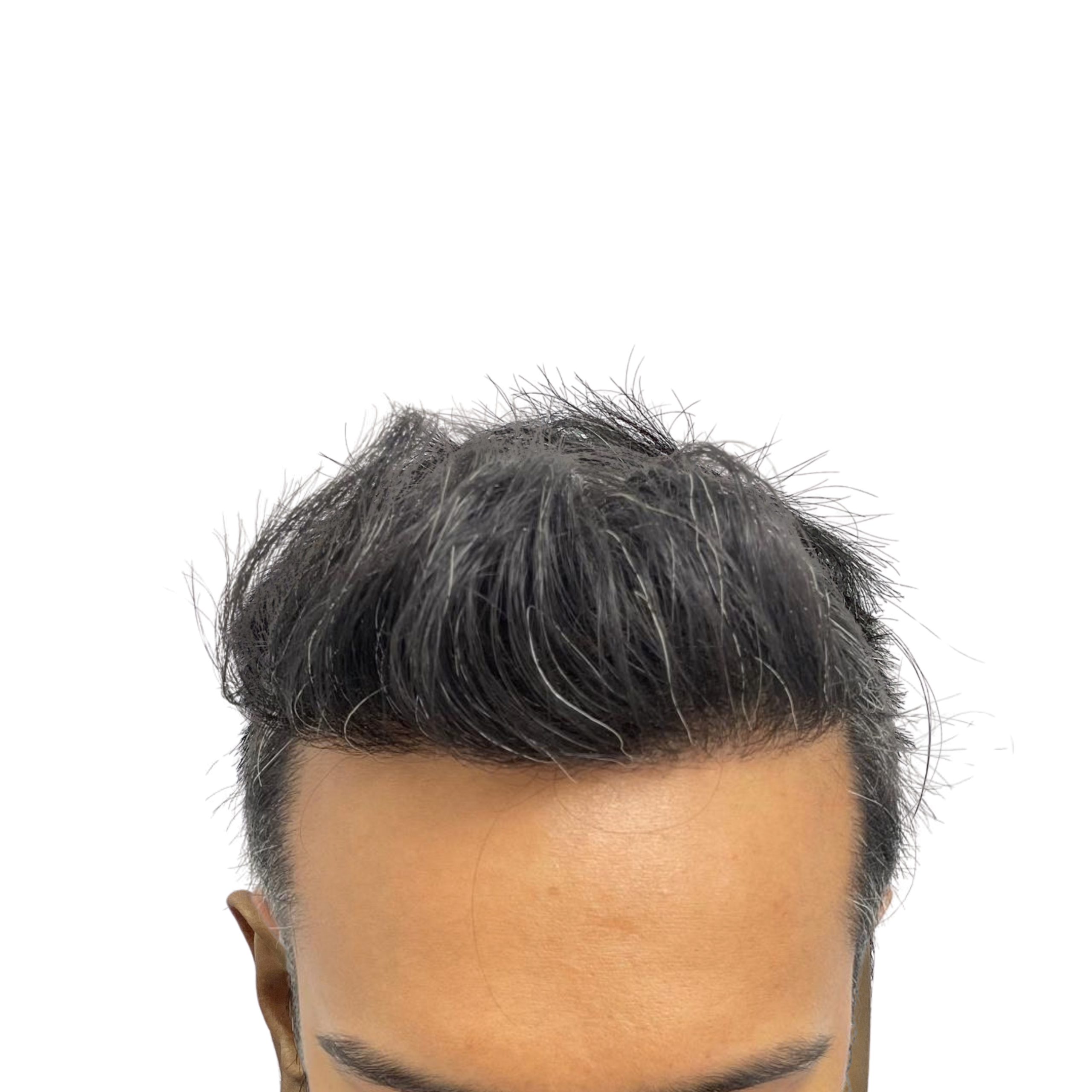 Sakir After