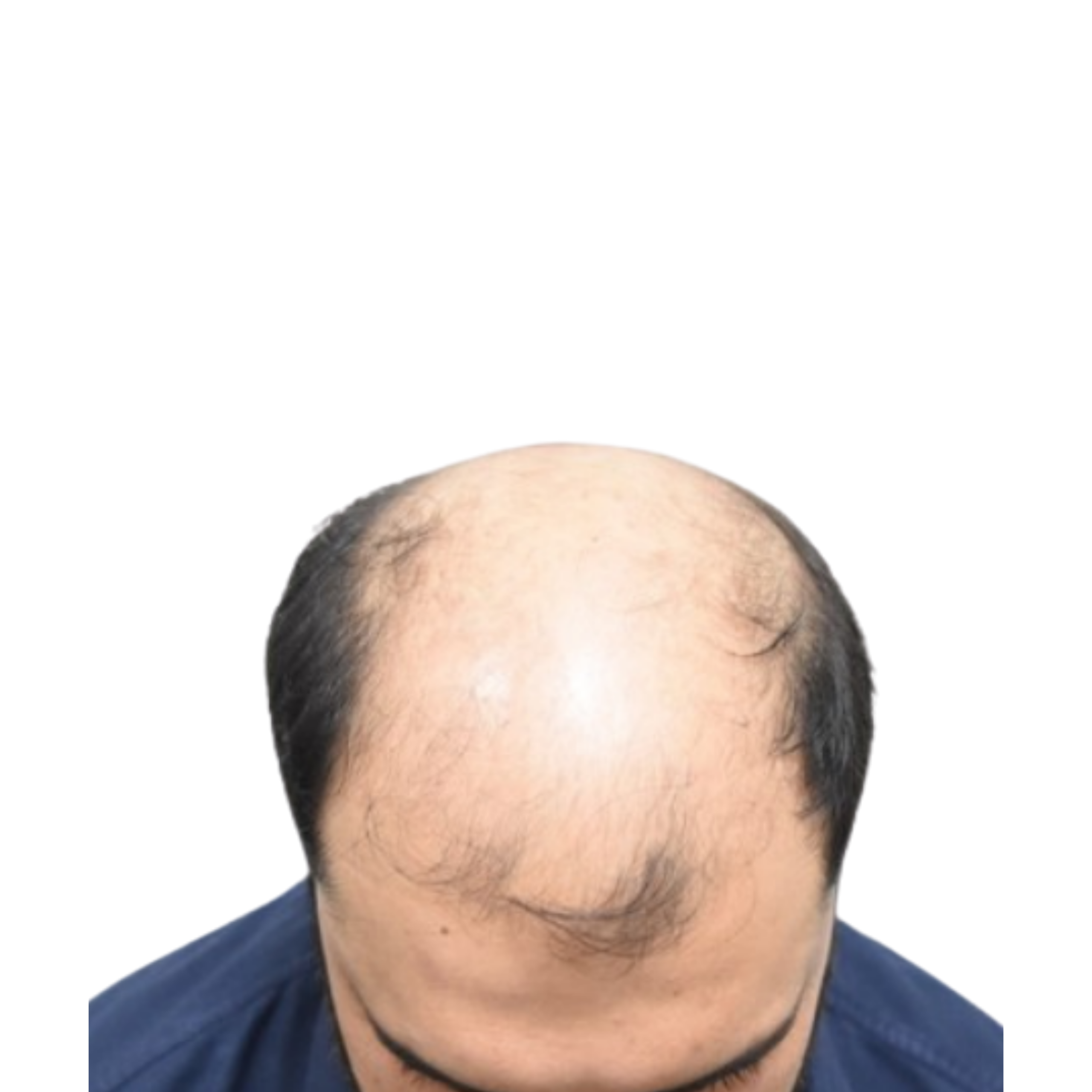 Taj before