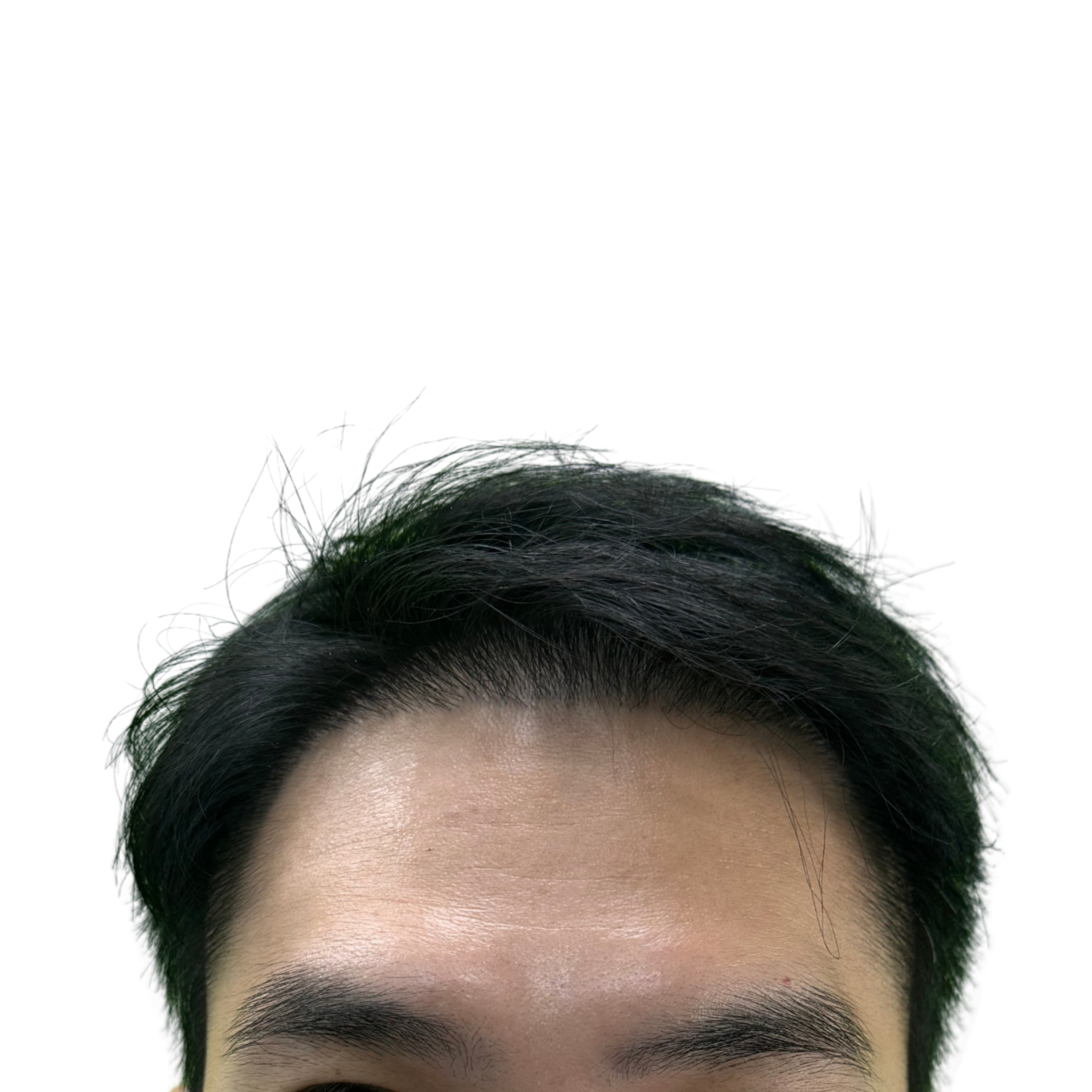 Viet After