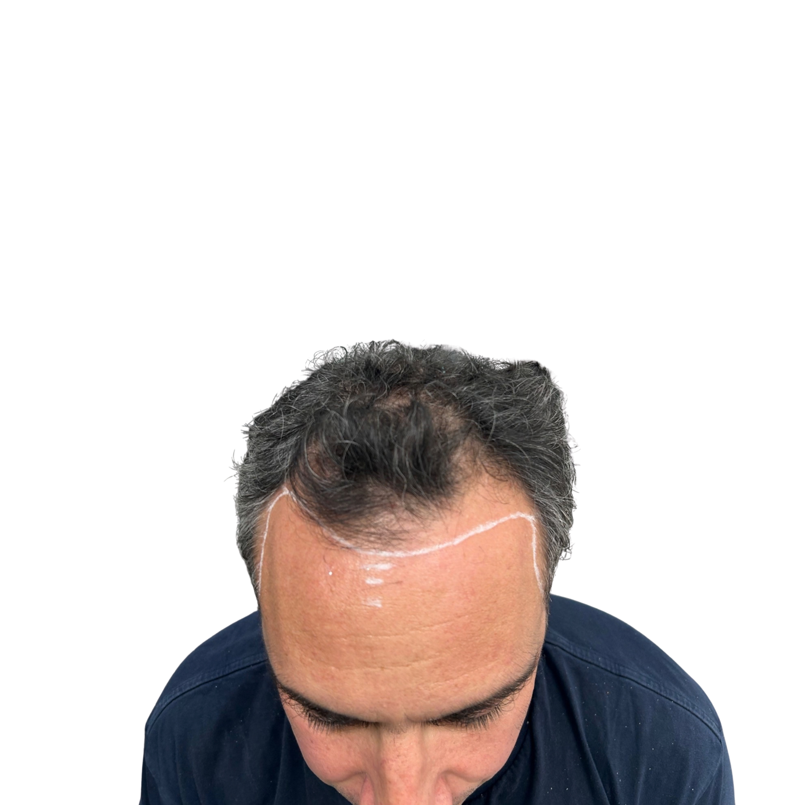 Vincenzo before